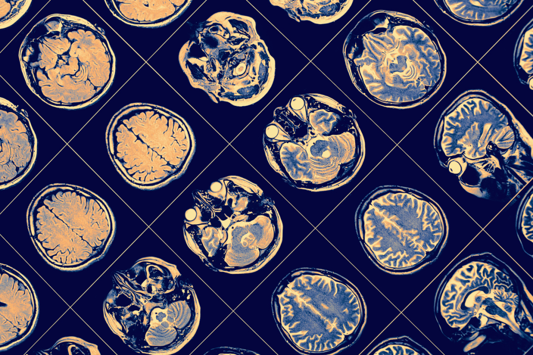 Cortex Suppression Resolves Motivation Conflict in Favour of Prosociality Illustration for news: Cortex Suppression Resolves Motivation Conflict in Favour of Prosociality
